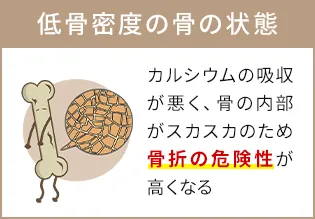 低骨密度の骨の状態　カルシウムの吸収が悪く、骨の内部がスカスカのため骨折の危険性が高くなる