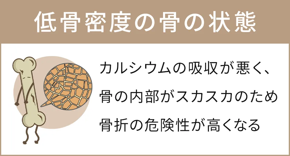 低骨密度の骨の状態　カルシウムの吸収が悪く、骨の内部がスカスカのため骨折の危険性が高くなる